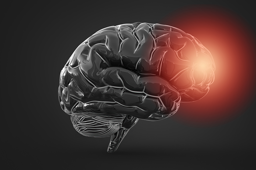 Is Alzheimer’s Disease Genetic? What You Need To Know
