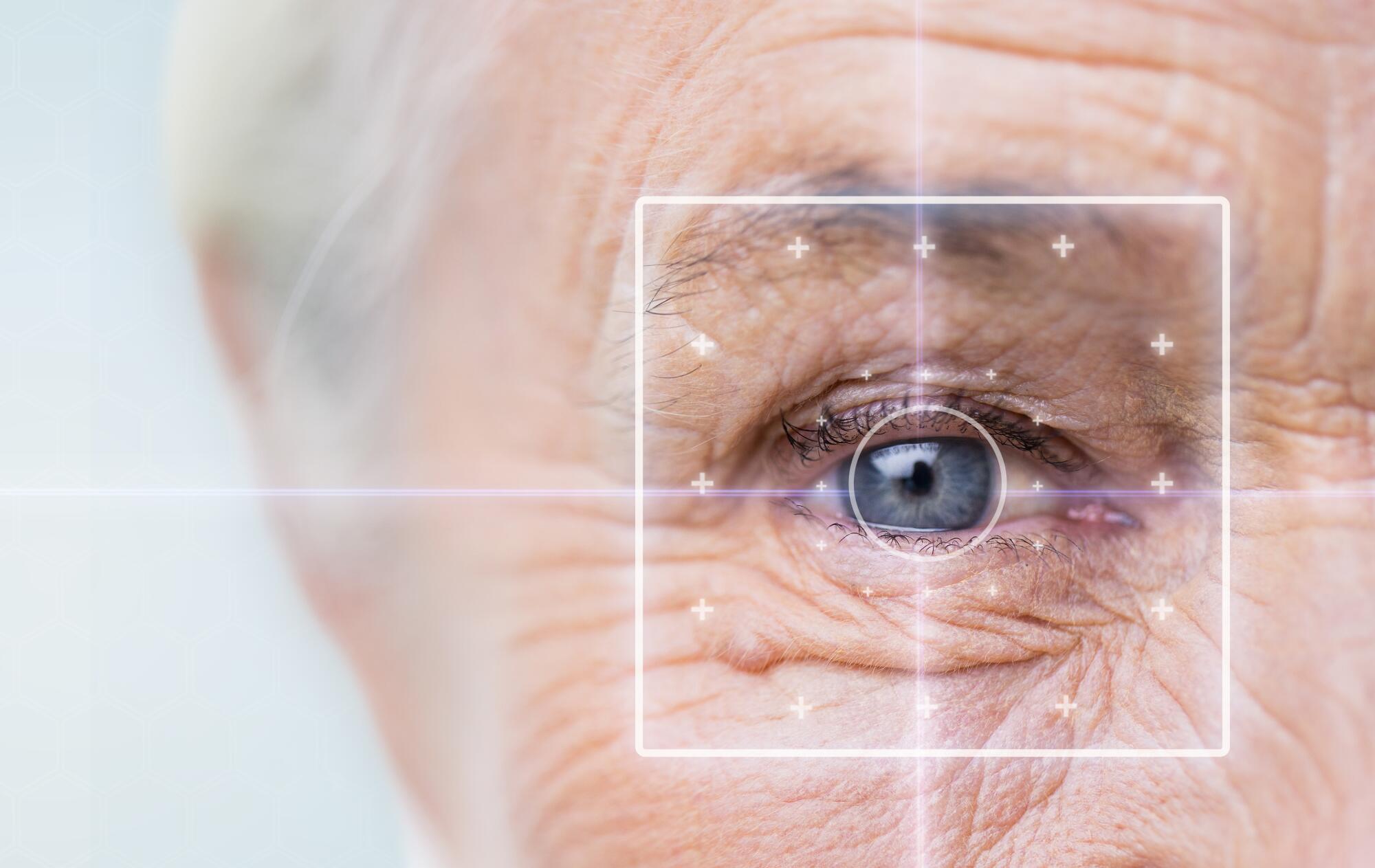 Glaucoma vs Cataracts: What Seniors and Families Need to Know