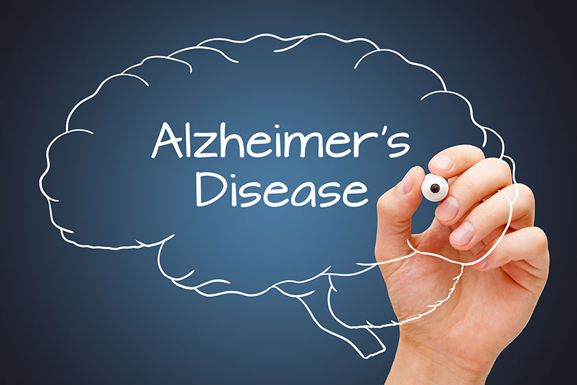Is Alzheimer's Disease Contagious? Debunking Misconceptions